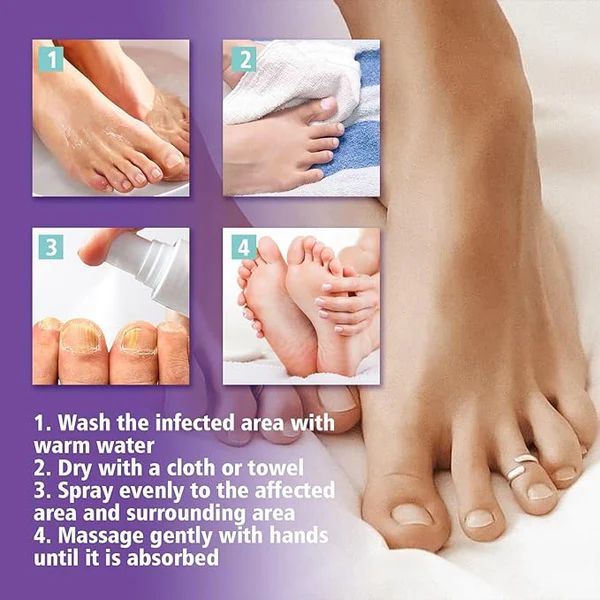 NailGuard™ Anti-Fungal Nail Care Spray