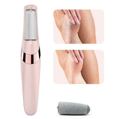 SoleSmooth™ Electric Foot File & Callus Remover