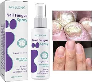 NailGuard™ Anti-Fungal Nail Care Spray