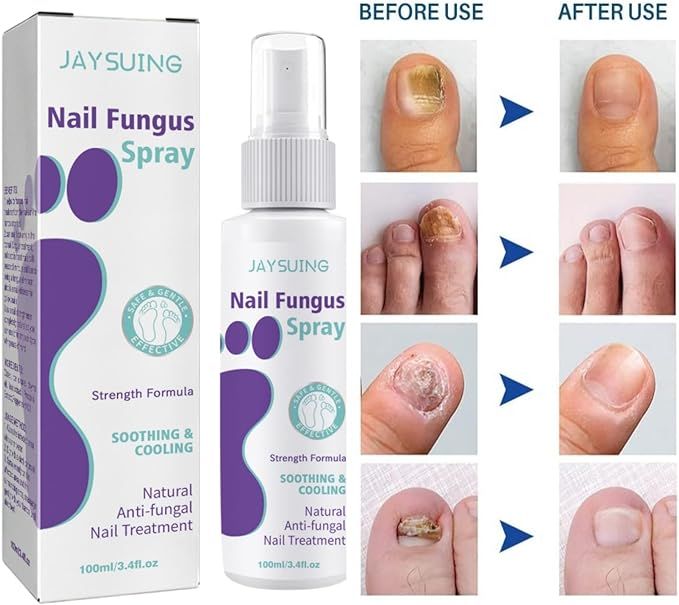 NailGuard™ Anti-Fungal Nail Care Spray