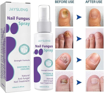 NailGuard™ Anti-Fungal Nail Care Spray