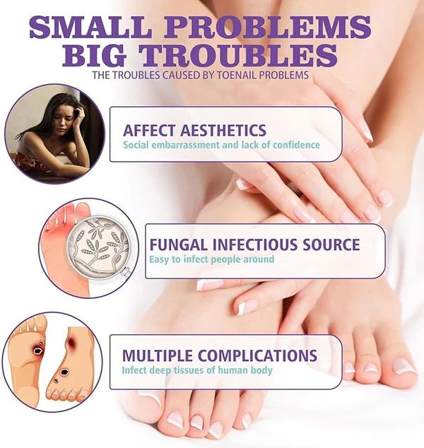 NailGuard™ Anti-Fungal Nail Care Spray