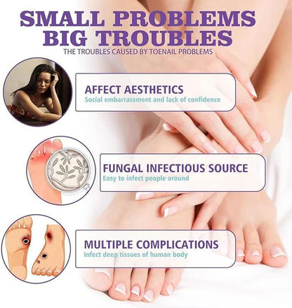 NailGuard™ Anti-Fungal Nail Care Spray