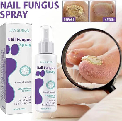 NailGuard™ Anti-Fungal Nail Care Spray